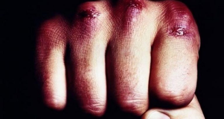 На Прикарпатті повідомили про підозру чоловіку, який з необережності вбив знайомого 7 kulak 2