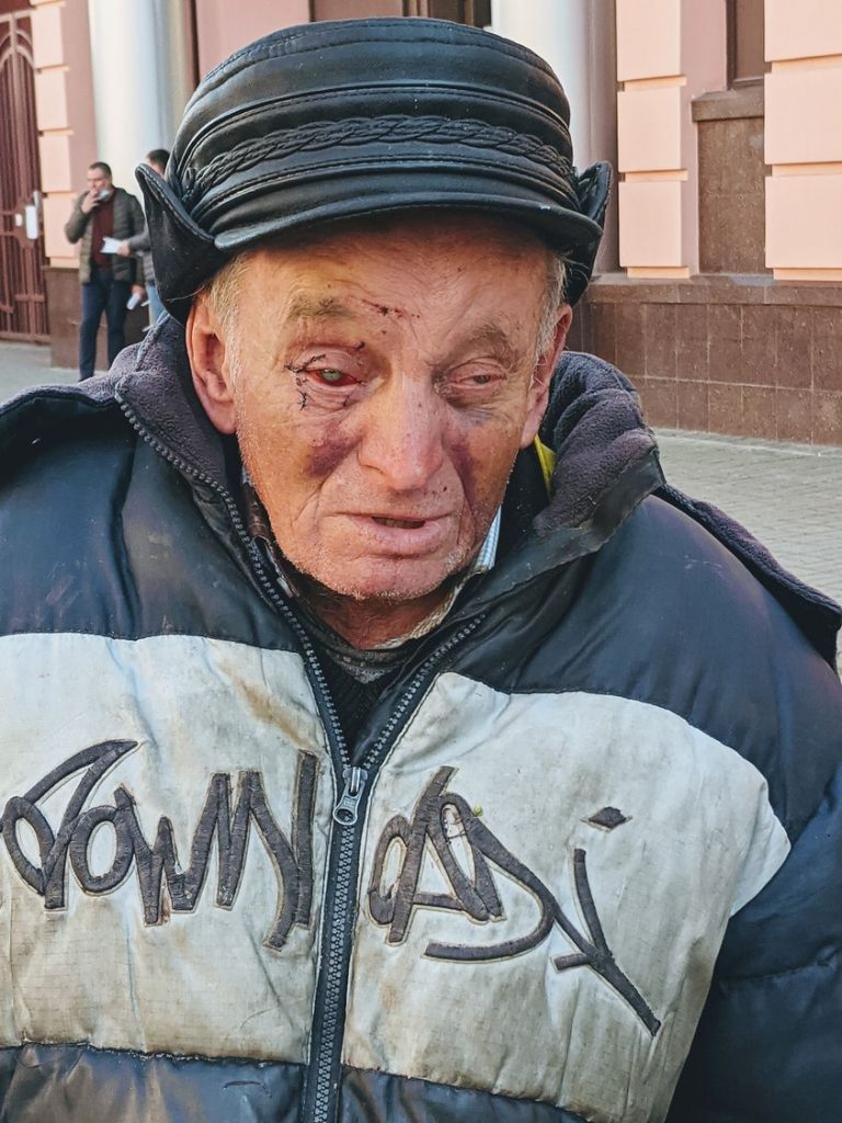 Очі в крові: франківського "грозу стометрівки" побили (ФОТО) 2 249872883 1476888389352512 1268182636271371548 n