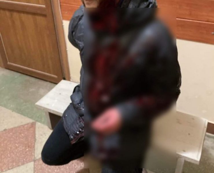 У Львівській області пораненого чоловіка проганяли з трьох лікарень (ФОТО)