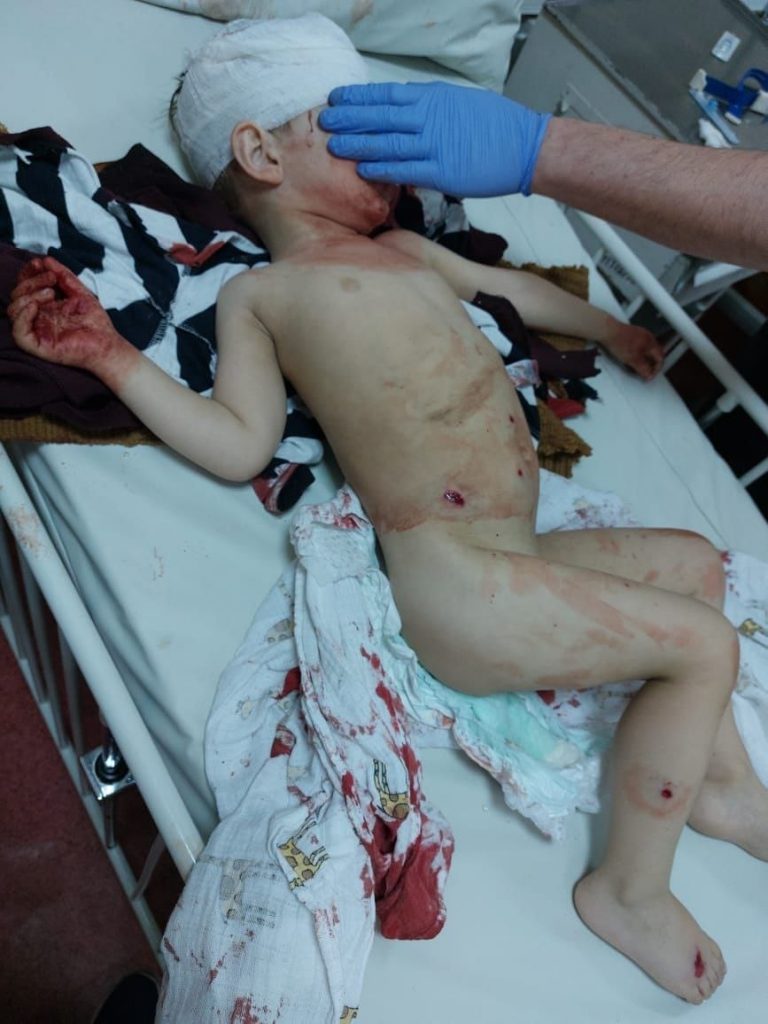 Росіяни обстріляли автоколону з біженцями під Запоріжжям 8 275633848 273786718267747 2365138902542489636 n