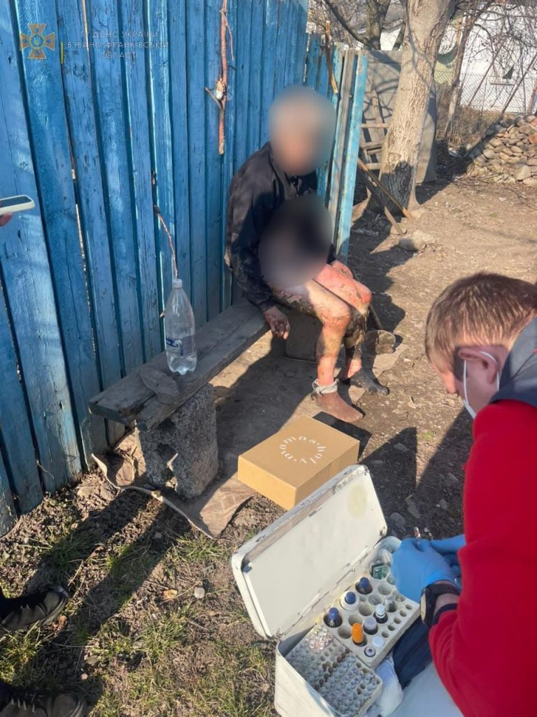 У Калуші спалювали суху траву: опіки отримала власниця городу (ФОТО) 11 У Калуші спалювали суху траву: опіки отримала власниця городу (ФОТО)