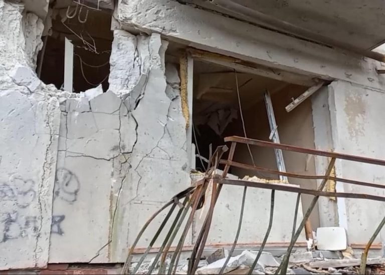 У Лисичанську росіяни ледь не вбили цілу родину: двом діткам можуть ампутувати ноги 3 У Лисичанську росіяни поранили родину: двом діткам можуть ампутувати ноги