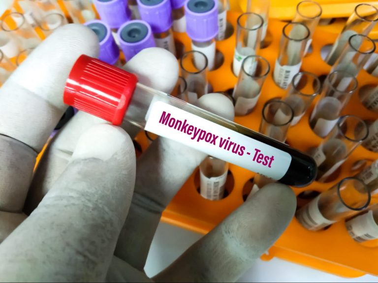Без паніки: в Україні вірус мавпячої віспи не зафіксований 11 249173