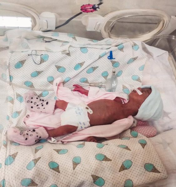 На 25 тижні вагітності: у Рогатині народилася маленька поспішайка (ФОТО)