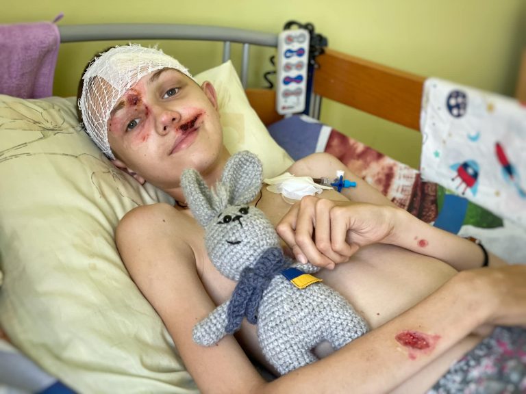 Дістали з-під завалів з уламком ракети в голові: у Львові прооперували хлопця з Донеччини 12 312219551 2724346991034089 8149853668062911835 n