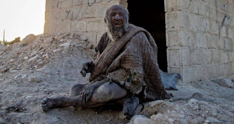 60 років не мився: в Ірані помер "найбрудніший чоловік у світі" (ФОТО)
