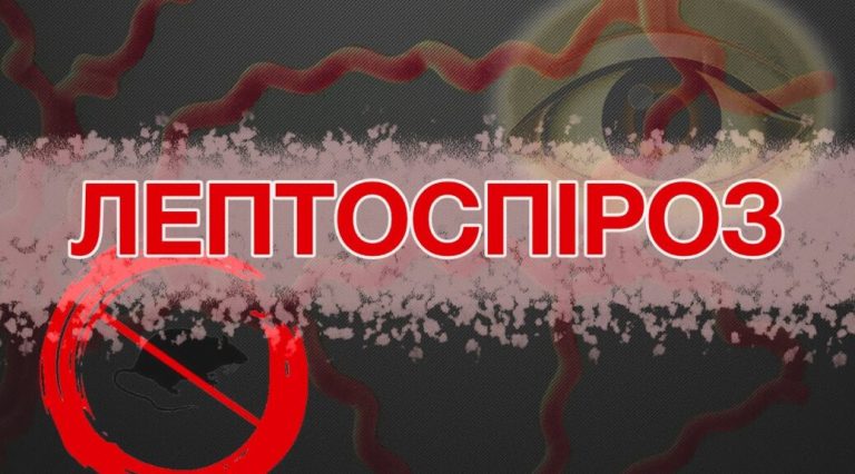 031023 leprospiroz 1038x576 1