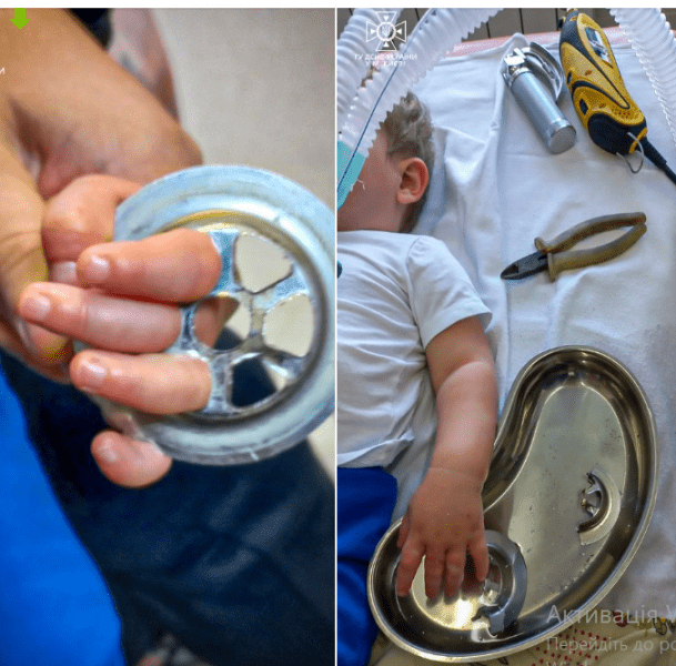 Небезпечні ігри: у Києві рука дитини застрягла у сітці кухонної раковини (ФОТО)