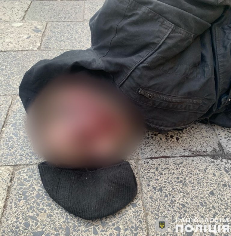У Львові чоловік з бритвою напав на студентку в університеті (ФОТО) 5 430842703 802401921931581 7254179941885881118 n