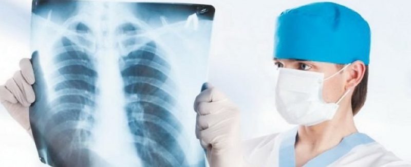 Як пацієнтам з туберкульозом отримати безоплатно медичну допомогу в Івано-Франківській області