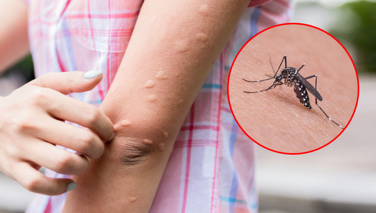 Надокучливі комахи: як відлякати комарів та що робити при укусах