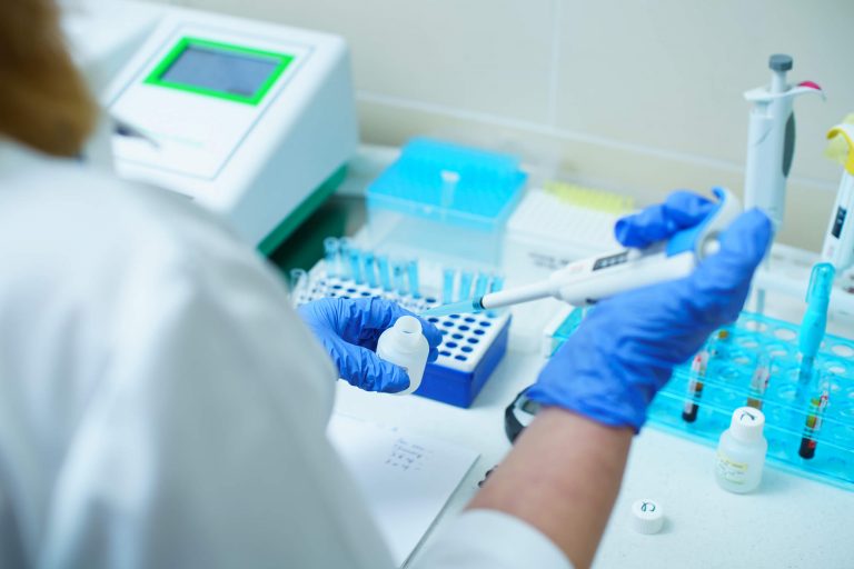 Аналіз крові на сечовину 13 Laboratornaya diagnostika