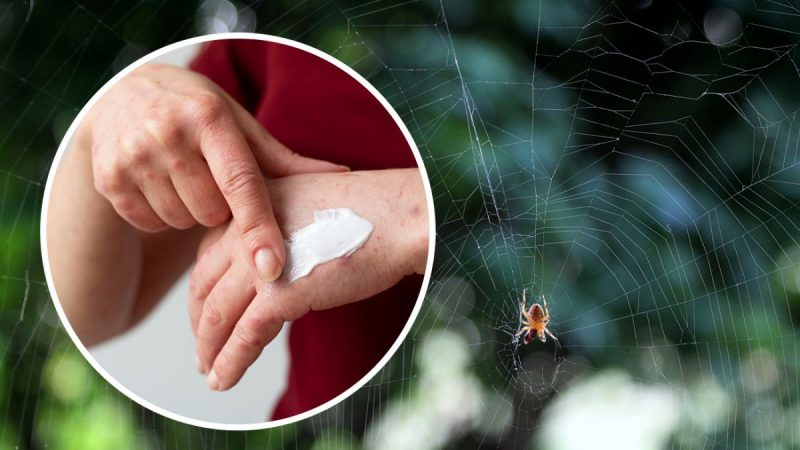 З початку року 13 українців вкусив павук: що варто знати