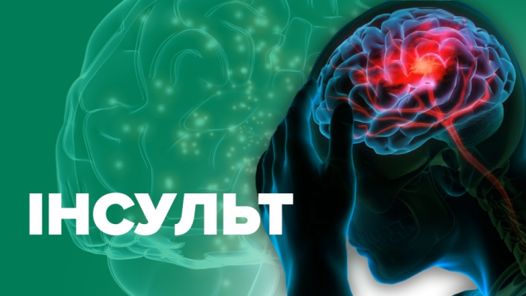 ТОП-5 факторів, що спричиняють 80% усіх випадків інсульту 7 ТОП-5 факторів, що спричиняють 80% усіх випадків інсульту
