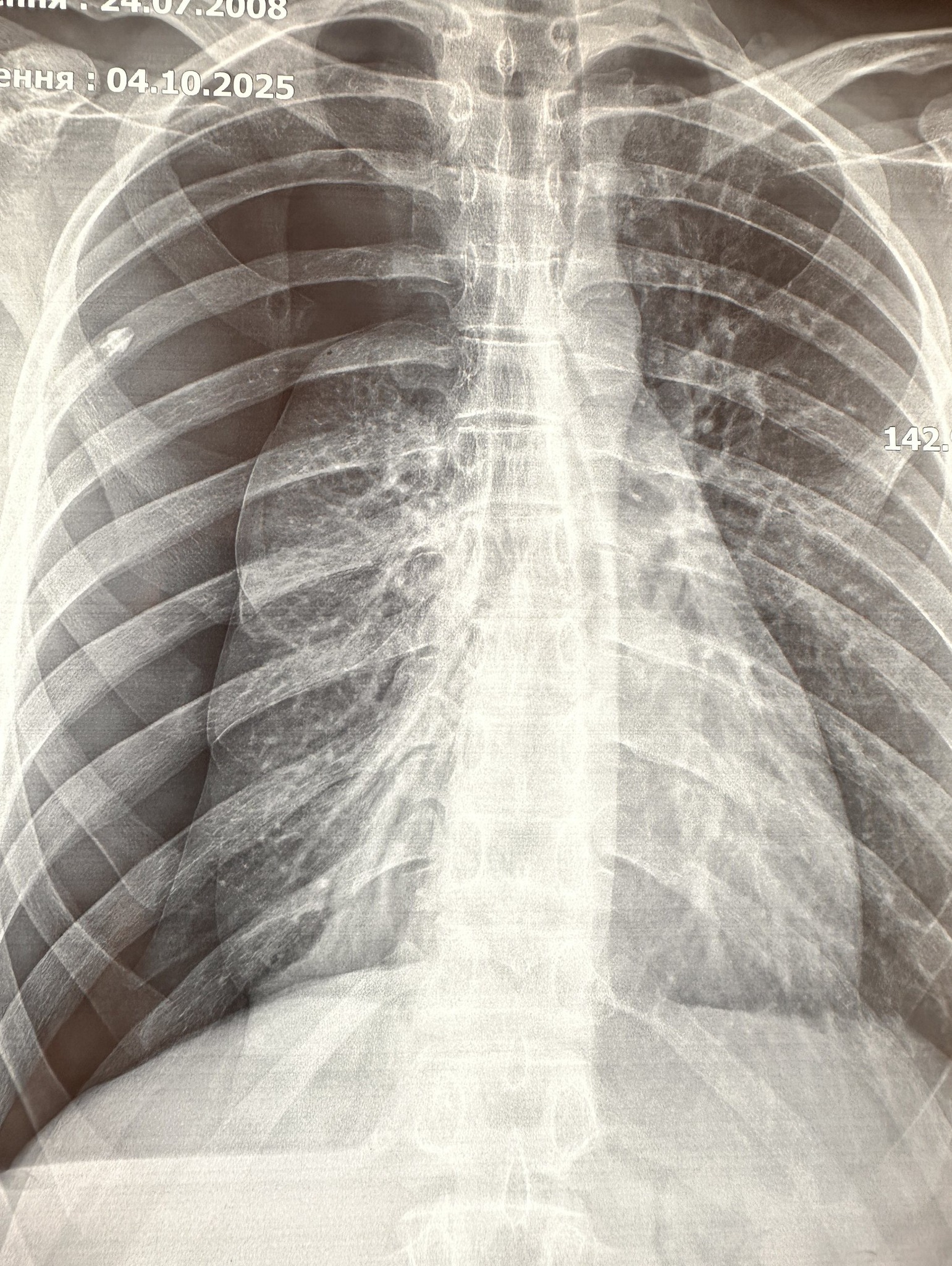 586543917 1330671215467319 5466457862266224519 n