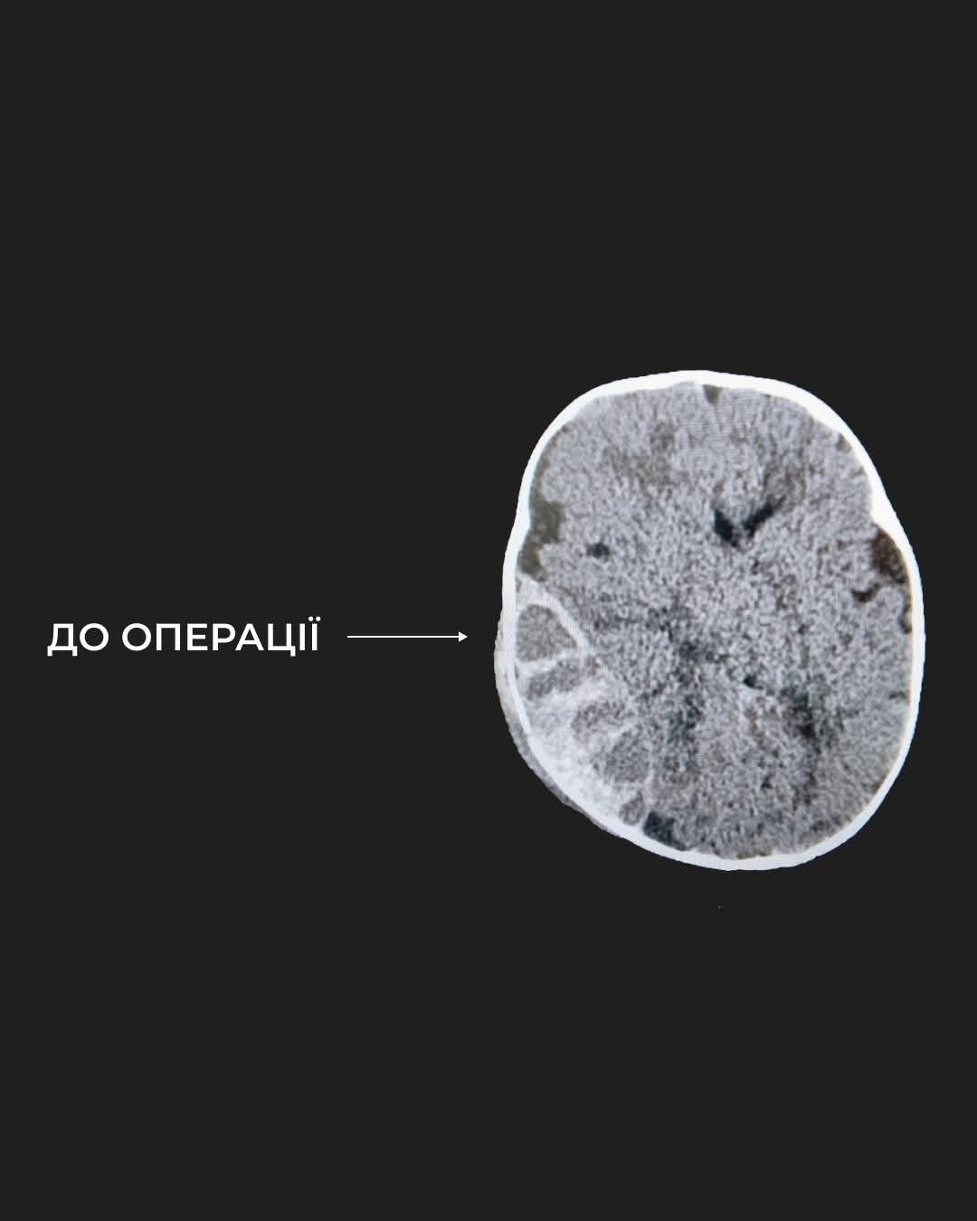 У Львові врятували 6-місячного сина воїна з критичною травмою голови 2 FB IMG 1762456772573