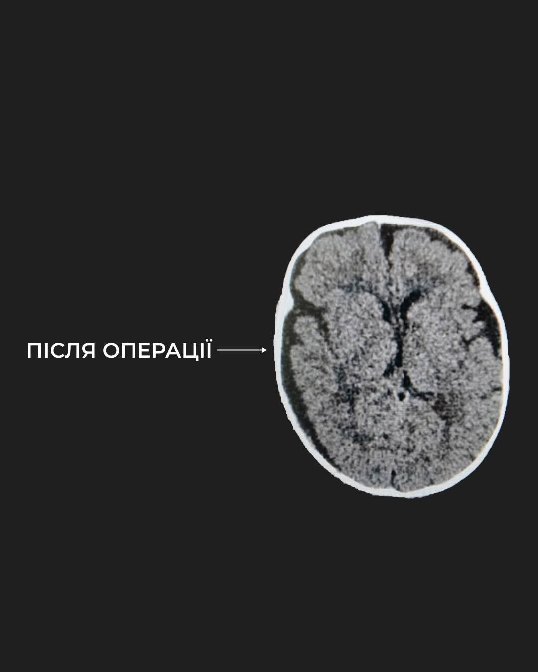 У Львові врятували 6-місячного сина воїна з критичною травмою голови 3 FB IMG 1762456775469