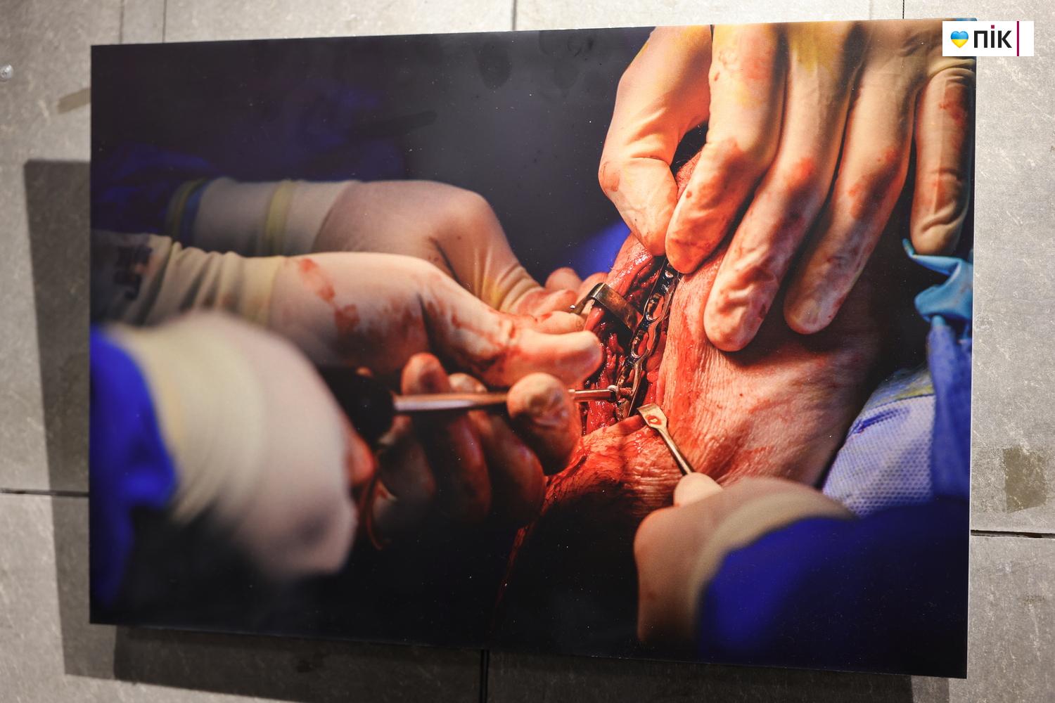 В Івано-Франківську відкрили благодійну фотовиставку «Hands Between Life and War» 3 G71A8565 resize