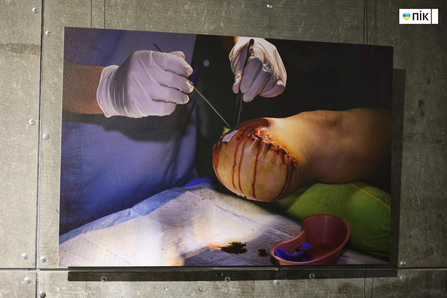 В Івано-Франківську відкрили благодійну фотовиставку «Hands Between Life and War» 4 G71A8596 resize