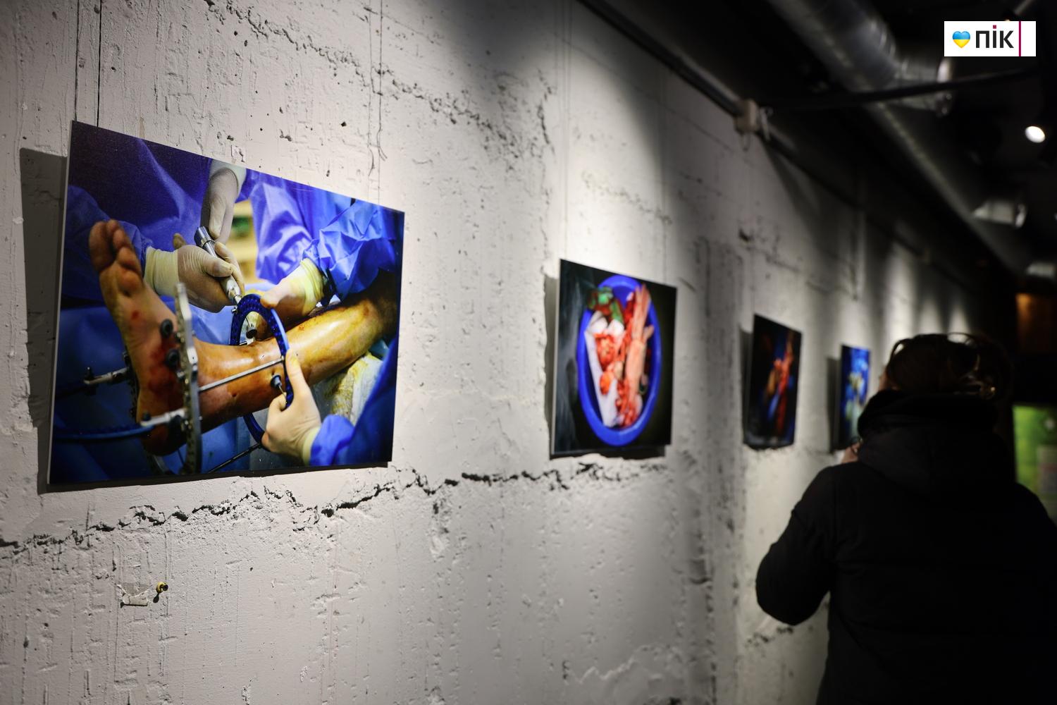 В Івано-Франківську відкрили благодійну фотовиставку «Hands Between Life and War» 14 G71A8784 resize
