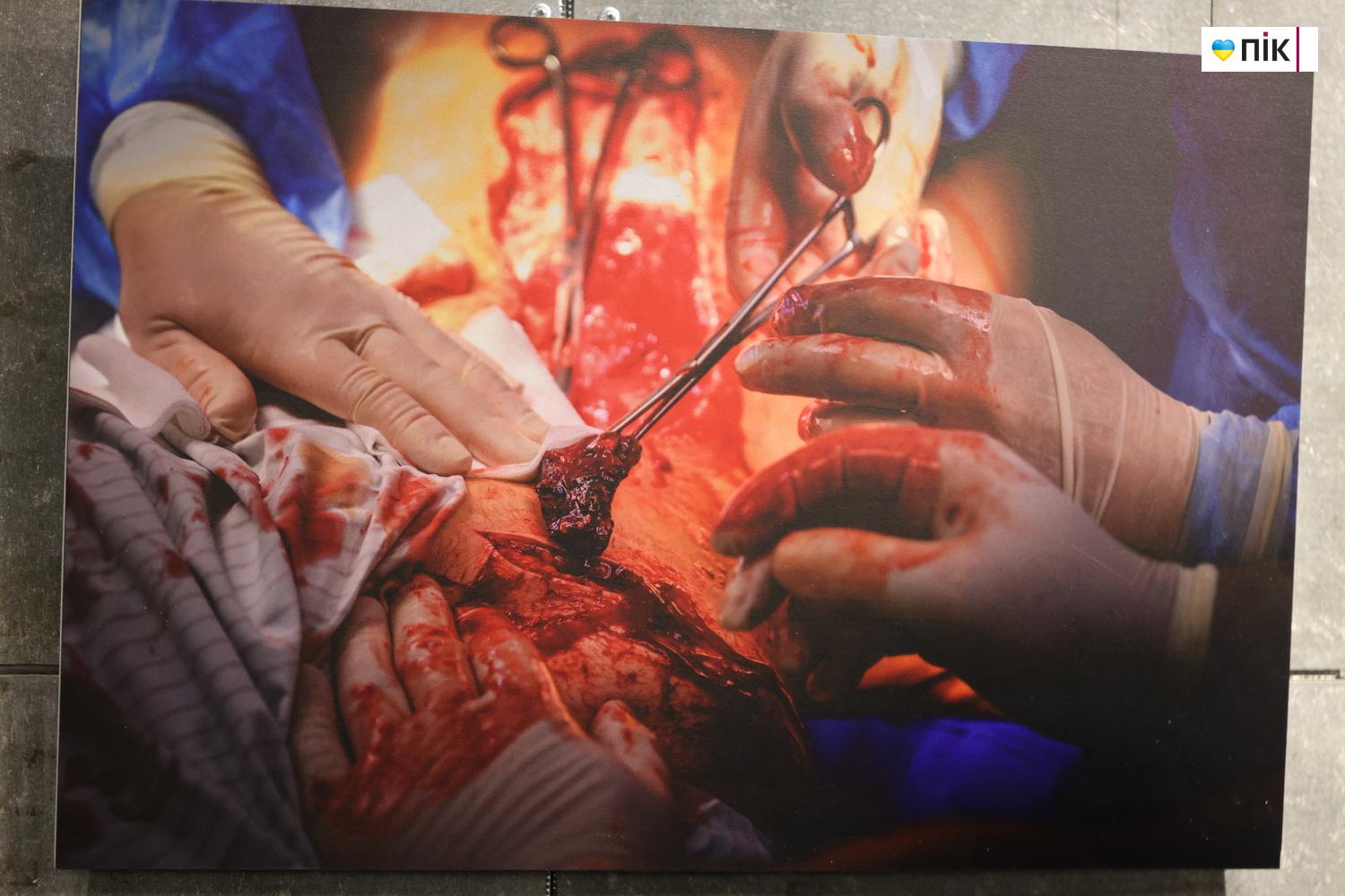 В Івано-Франківську відкрили благодійну фотовиставку «Hands Between Life and War» 6 G71A8804 resize