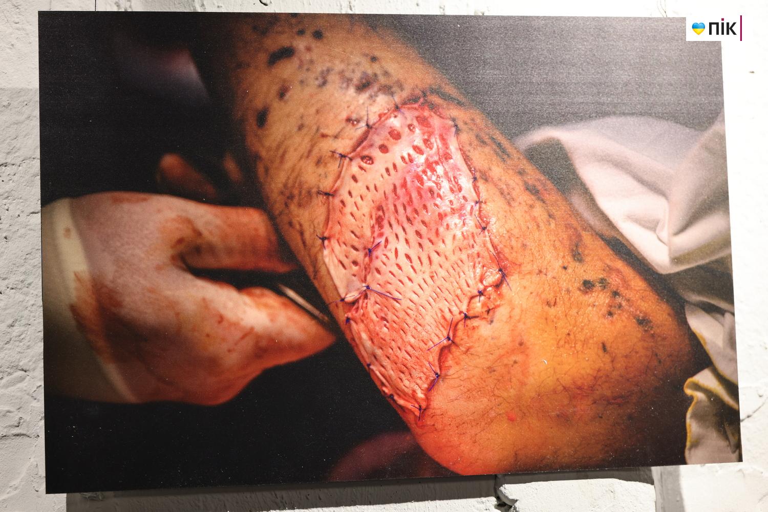 В Івано-Франківську відкрили благодійну фотовиставку «Hands Between Life and War» 7 G71A8816 resize