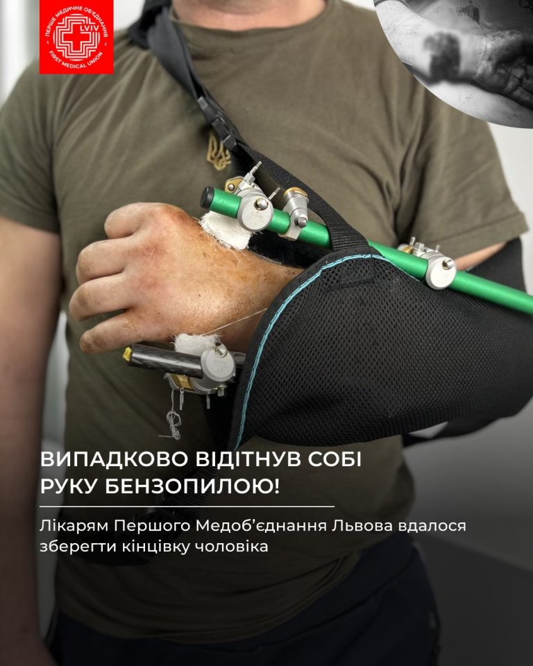 На Львівщині чоловік випадково відітнув собі руку бензопилою 3 643866885 1247953690808378 589301868964340553 n