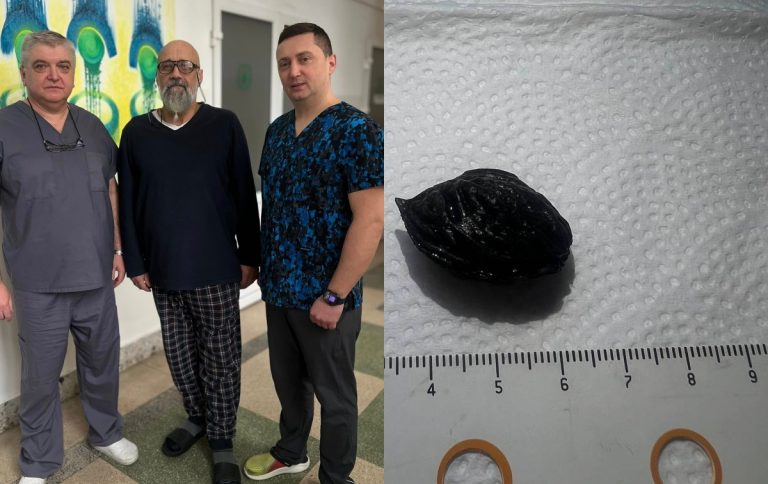 Житель Львівщини ледь не помер через персикову кісточку, яка застрягла у кишківнику 12 Fotoram.io 4