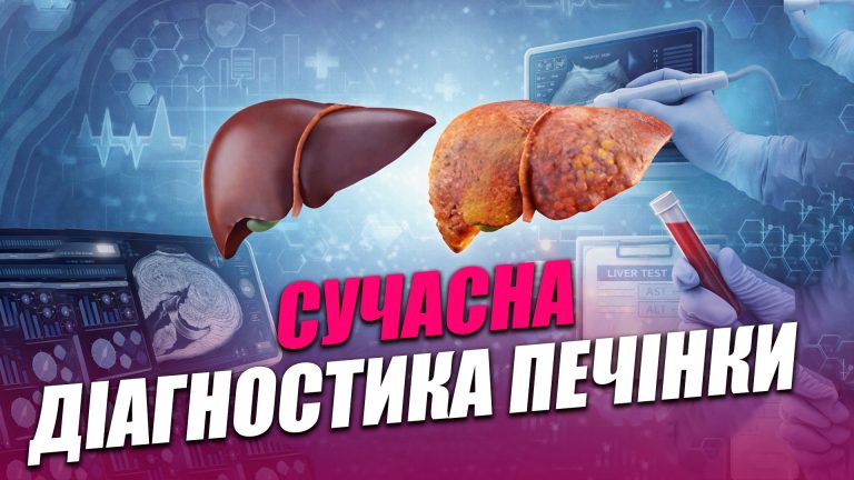 Стеатометрія: сучасна діагностика печінки в Івано-Франківську (ВІДЕО) 7 Obkladynka goryzontalna 4 1