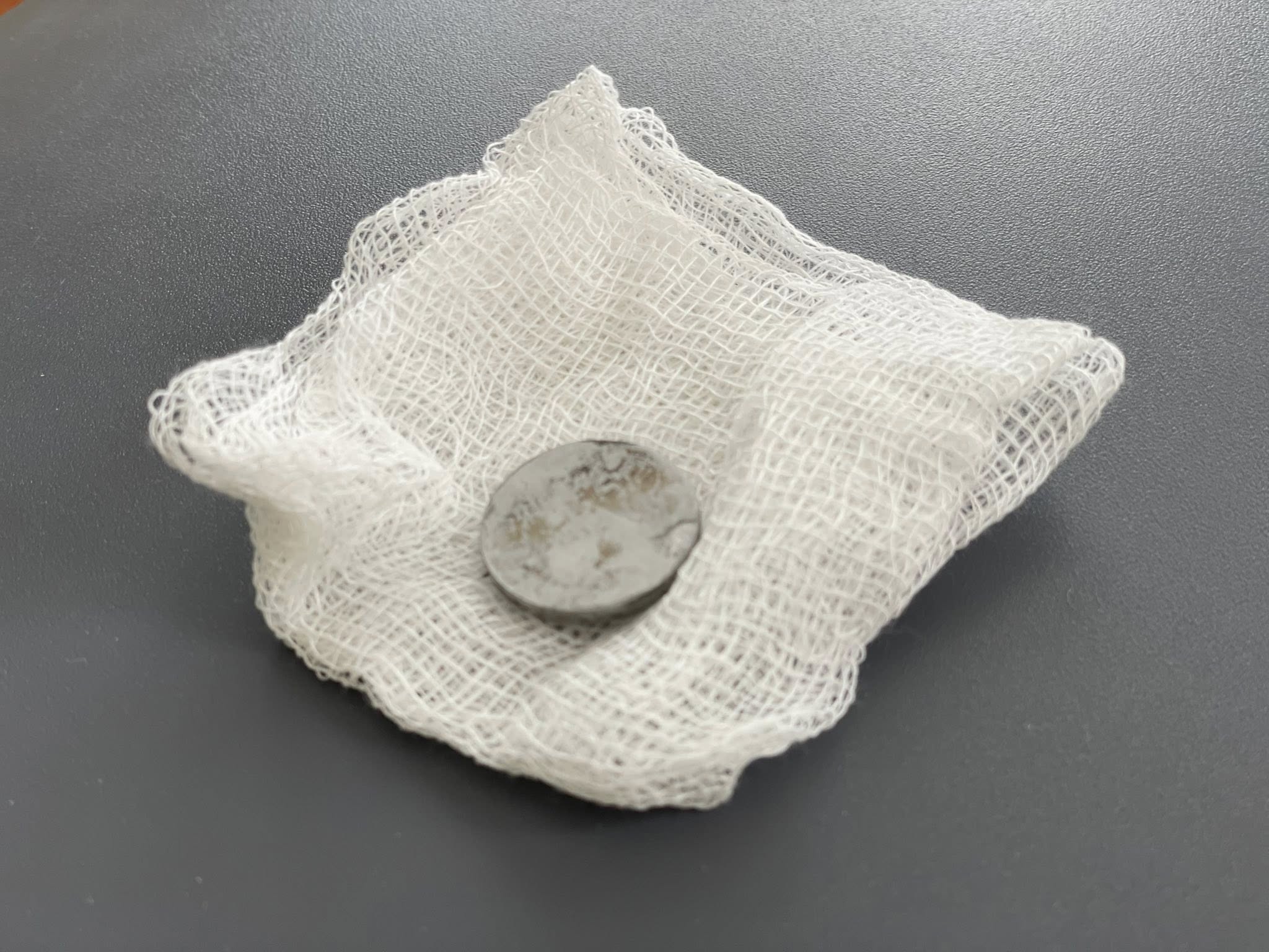 У Львові 2-річна дівчинка три місяці прожила із батарейкою в стравоході 3 664727386 122381472428086720 5835682973841648825 n