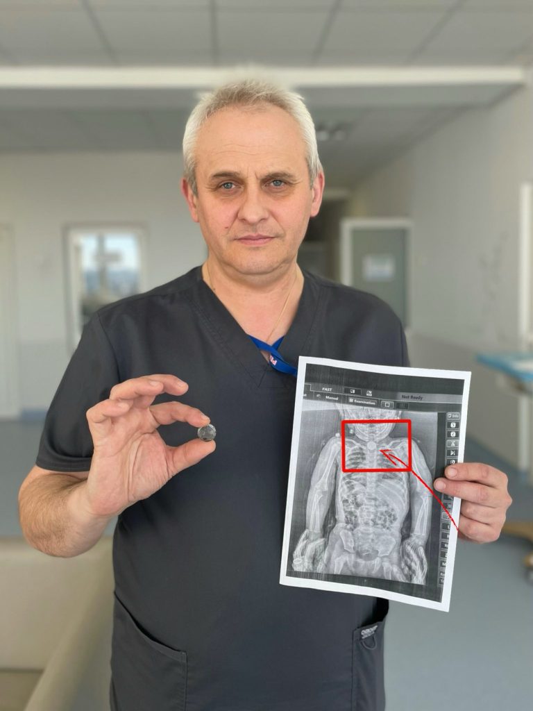 У Львові 2-річна дівчинка три місяці прожила із батарейкою в стравоході 10 665928752 122381472386086720 8877899477069276812 n