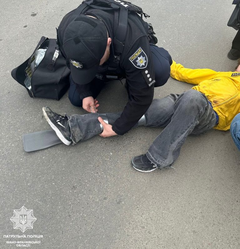 Лежав посеред дороги: як у Франківську допомогли хлопцю, що впав із самоката 3 Лежав посеред дороги: як у Франківську допомогли хлопцю, що впав із самоката