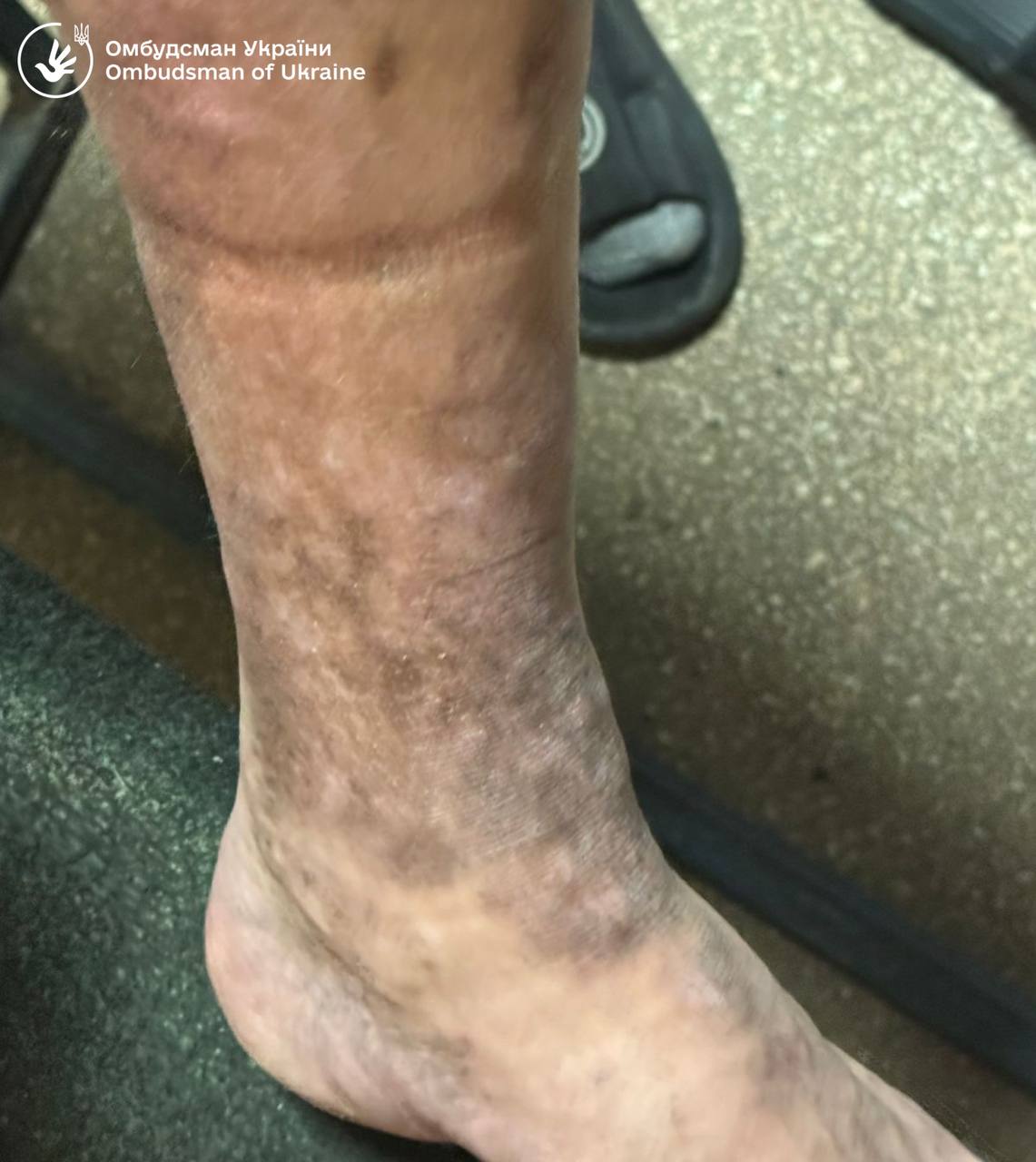 Незаконне утримання, антисанітарію та ігнорування хвороб виявили в Ужгородському районному ТЦК та СП 2 photo 5371032684882236142 y