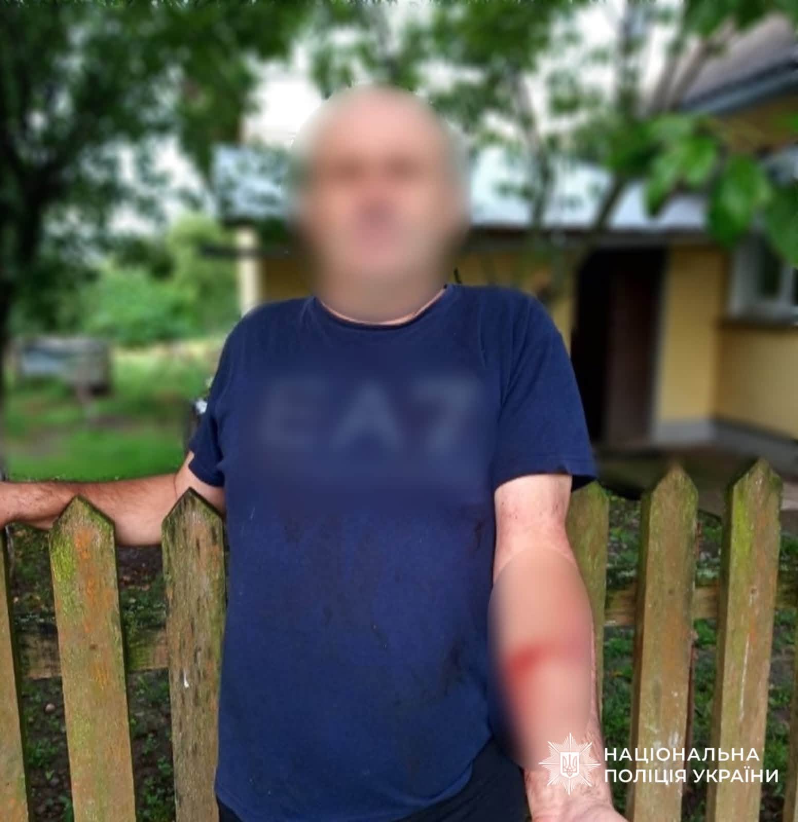 Разом дивилися футбол: на Прикарпатті стався смертельний конфлікт (ФОТО) 2 752488624 1041490471858515 6904596668681407840 n